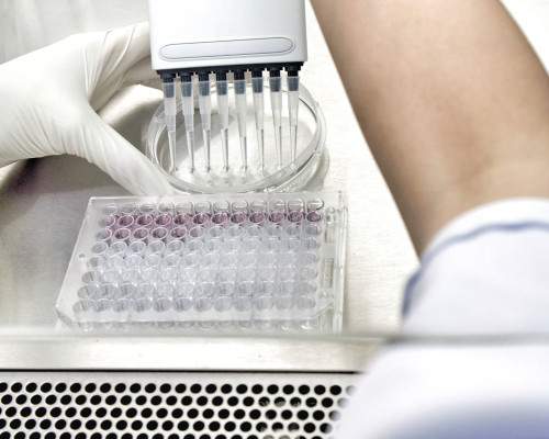 Recombinant Expression of Proteins