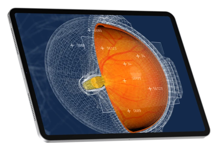Visual representation of Toku Eyes' AI platform analysing retinal images