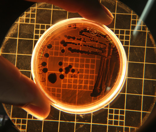 Microorganisms in a petri dish - photo by Wassily Kandark